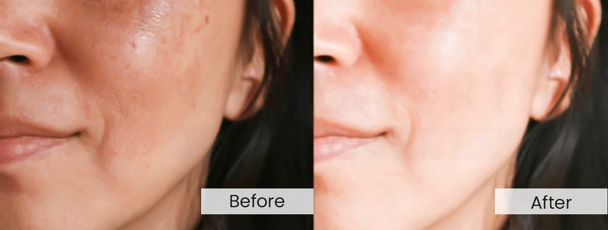 Product-Results-Before-and-After-Images-for-a-skincare-product